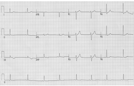 Figure2