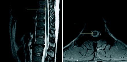 Figure2