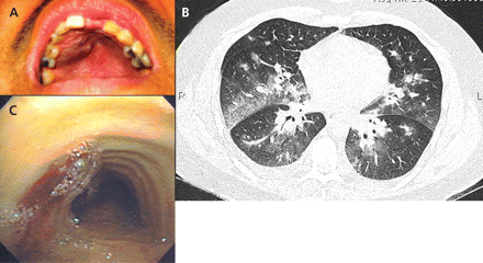 Figure1