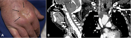 Figure1