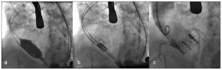 Figure3