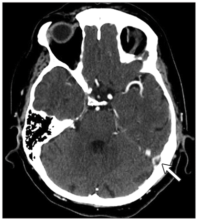 Figure 3: