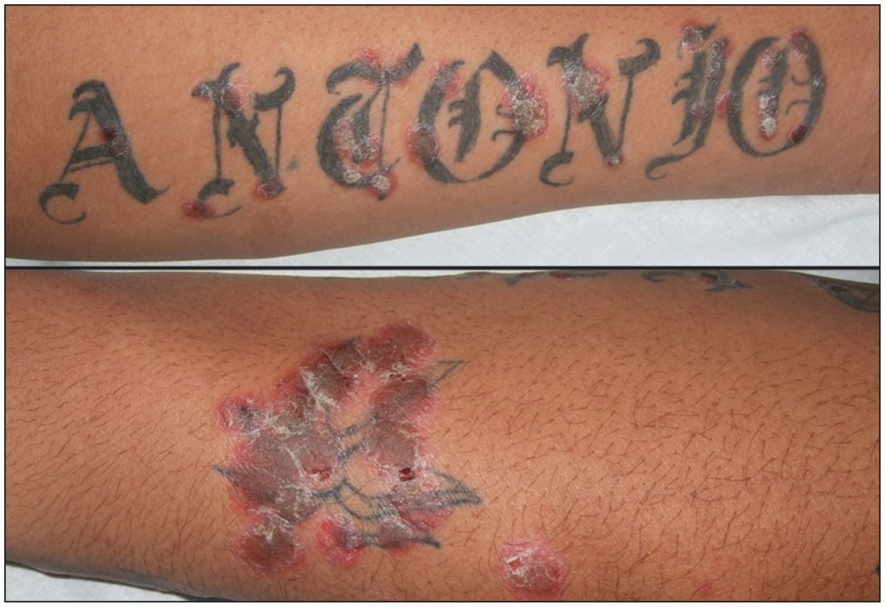 eucerin lotion on tattooTikTok Search
