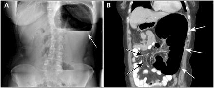 Figure 1: