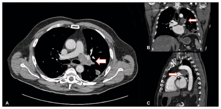 Figure 2: