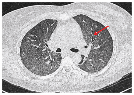 Figure 2: