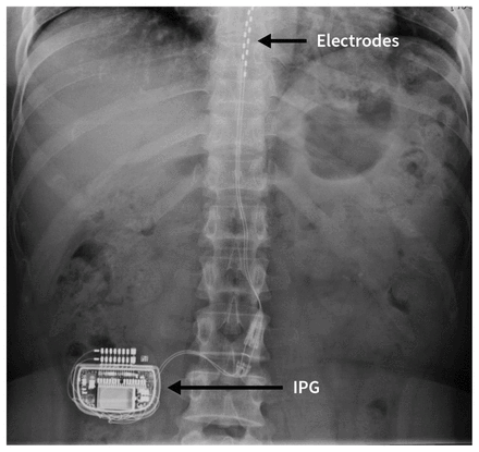 Figure 2: