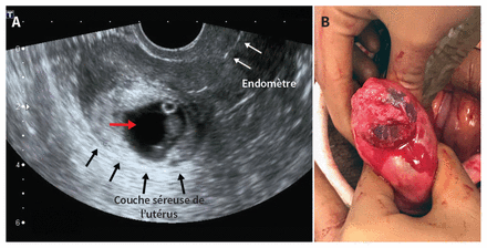 Figure 1: