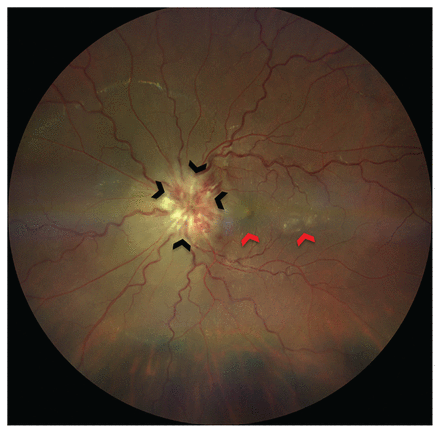 Figure 2: