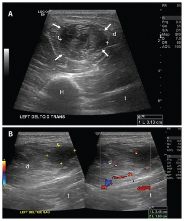 Figure 2: