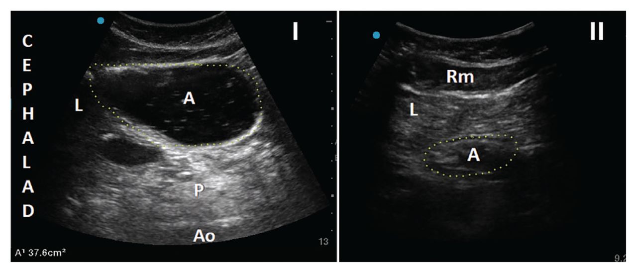 unstable presentation in ultrasound