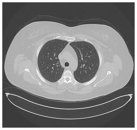 Figure 2: