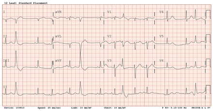 Figure 5: